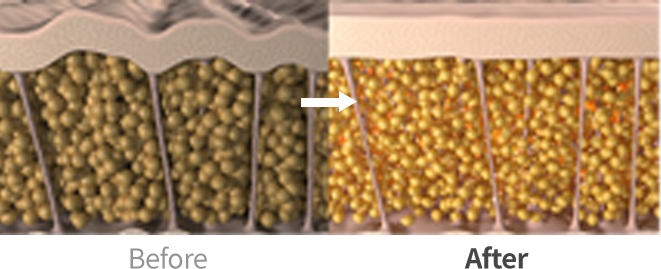 온다리프팅이미지