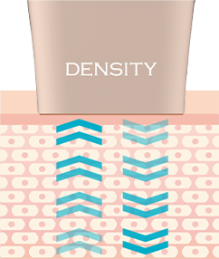 키포인트이미지