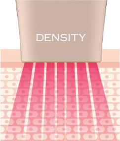 키포인트이미지